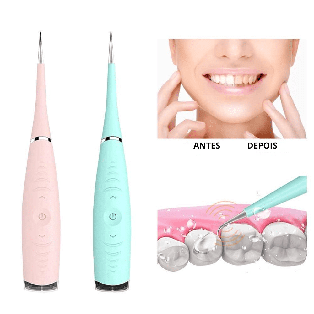 Aparelho Limpador Dental Elétrico Ultrassônico